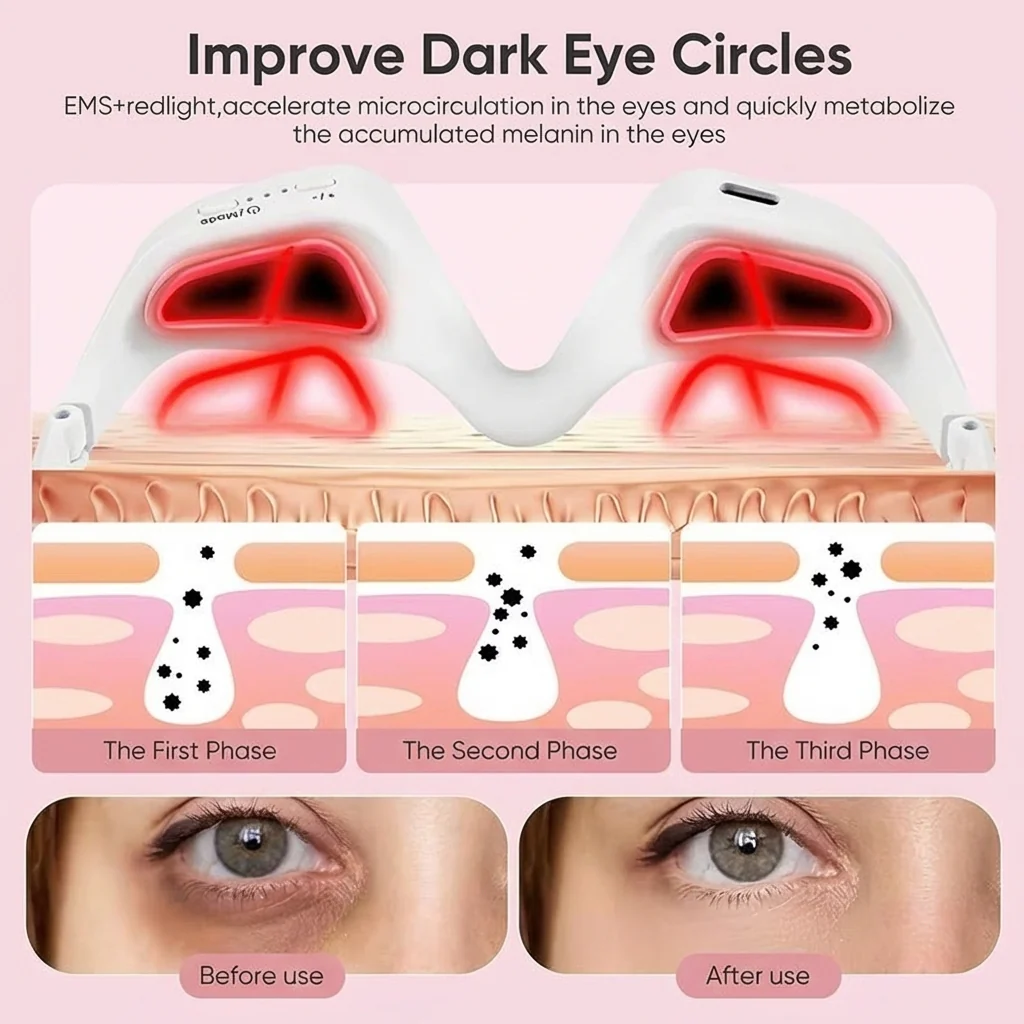 AuraEyes™ 2-en-1 : Thérapie par la lumière rouge + EMS pour estomper les poches sous les yeux - Image 6