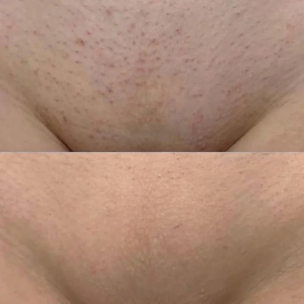 GlowShave 2.0 - Image 3