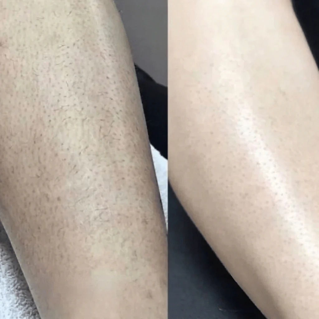 GlowShave 2.0 - Image 4