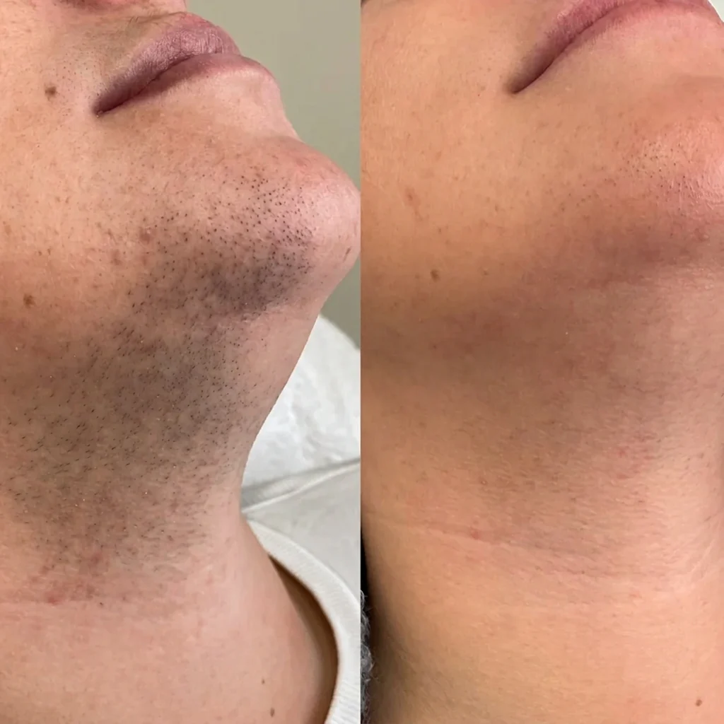 GlowShave 2.0 - Image 5