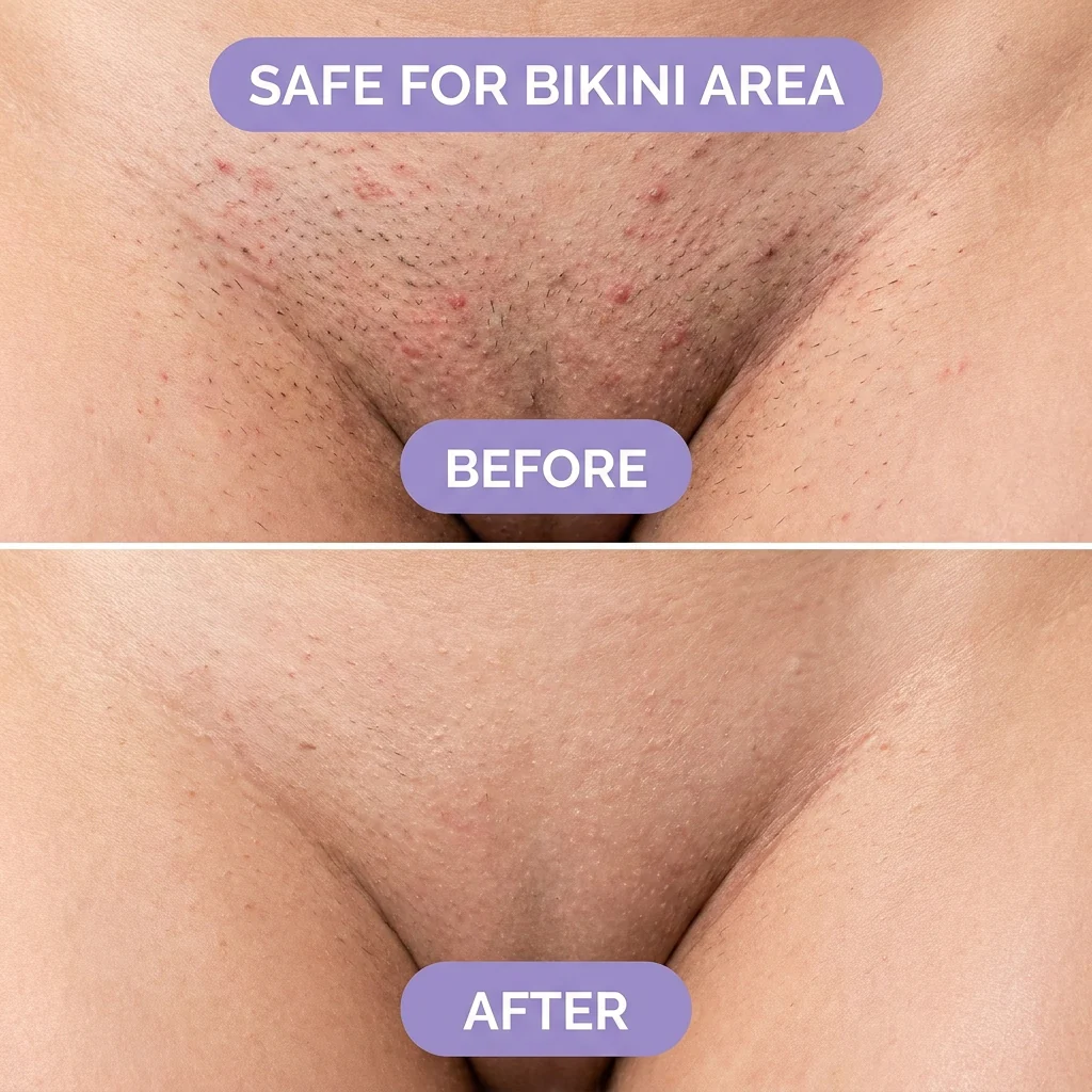 Silky - l’épilation la plus simple et sans douleur pour une peau lisse instantanément ! - Image 4